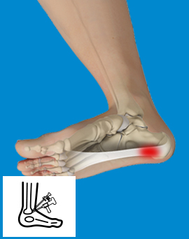 Foot & Ankle Images