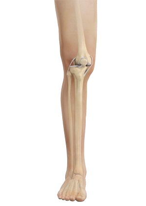 Knee Dislocation pic