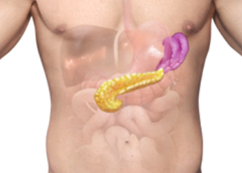 Spleen & Pancreas Conditions - Educational Photo