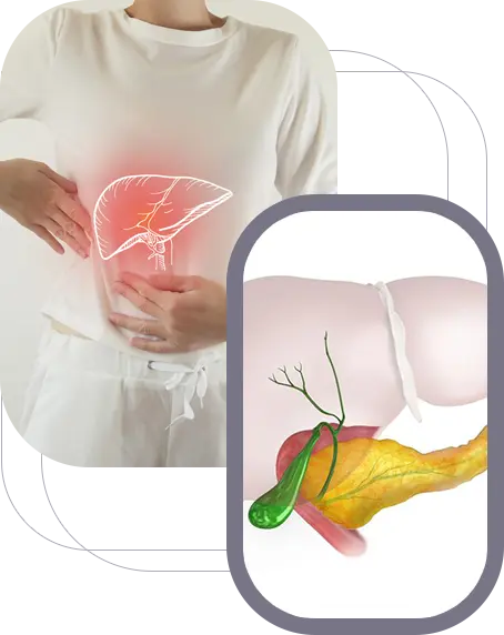 Gallbladder & 
Biliary Disease img