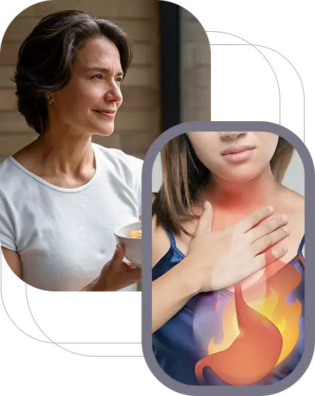 Reflux and Heartburn 
Management img
