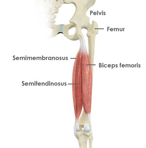 hamstring-tendon-repair-img