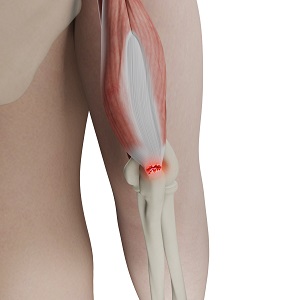 Shoulder_topic_heading - Condition