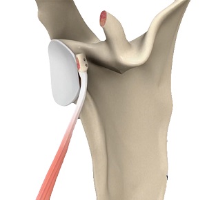 Shoulder_topic_heading - Condition