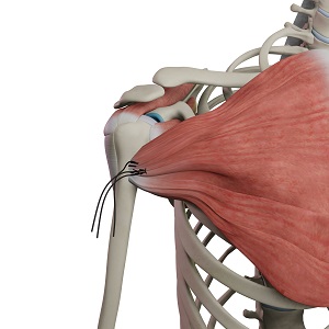 Shoulder_topic_heading - Condition