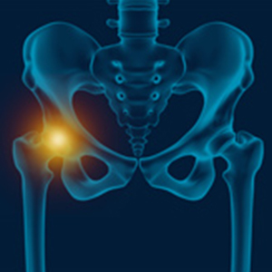 Hip Pain pic