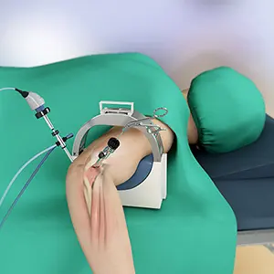 Elbow Arthroscopy Images