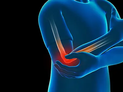 Elbow Injuries Images
