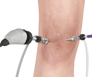 Knee Arthroscopy Images