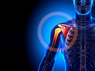 Shoulder Disorders Images