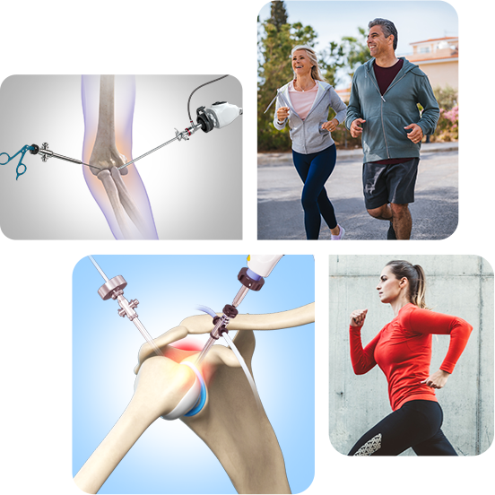 Arthroscopic Surgery Images