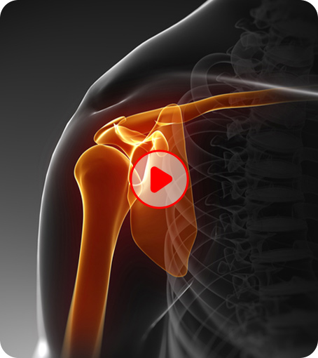 Patient Education Videos