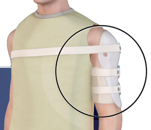 casting-splinting-img