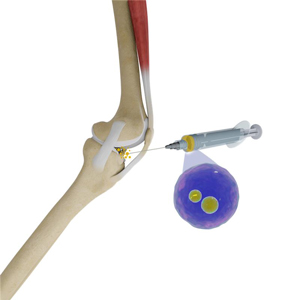 Exosomesexosomes pic