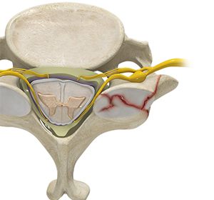 Cervical Fracture Images