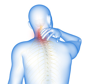 Cervical Spondylosis Images