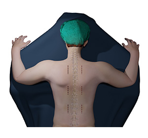 Complex Spinal Reconstruction Images