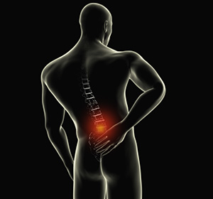 Lumbar Sprain Images