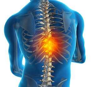 Thoracic Pain Images