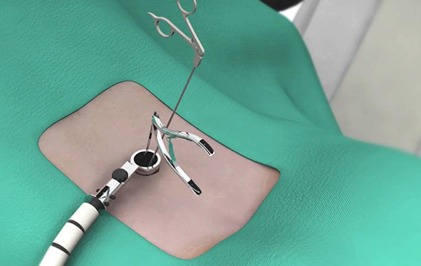 Minimally Invasive Images