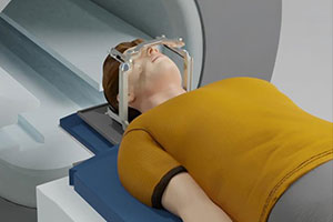 Minimally Invasive Brain Surgery - Educational Picture