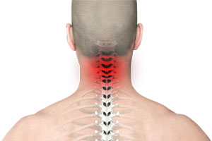 Neck and Back Injuries - Educational Picture