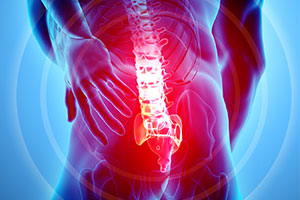 Spine Trauma - Educational Picture