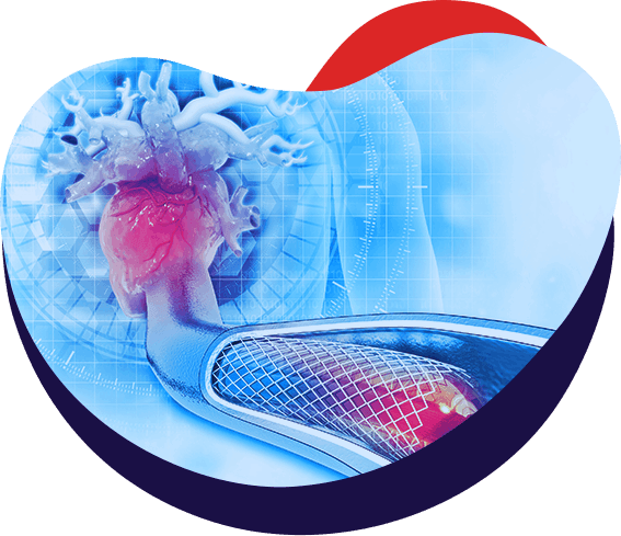 Interventional Cardiology Procedures