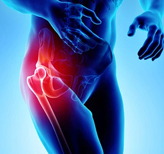 Picture of Hip Pain