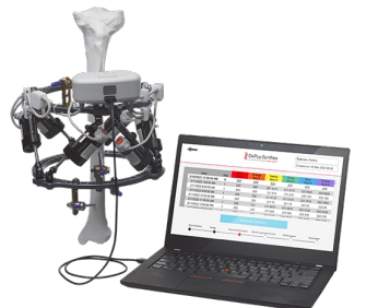 Picture of MAXFRAME™ Multi-Axial Correction System