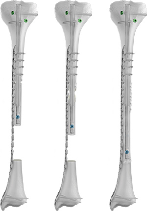 Picture of Balanced Cable Transport