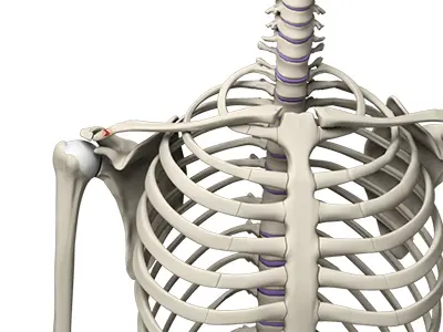 Clavicle Fracture Images