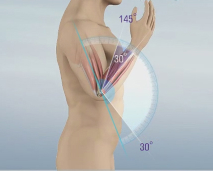 Elbow Contracture Images