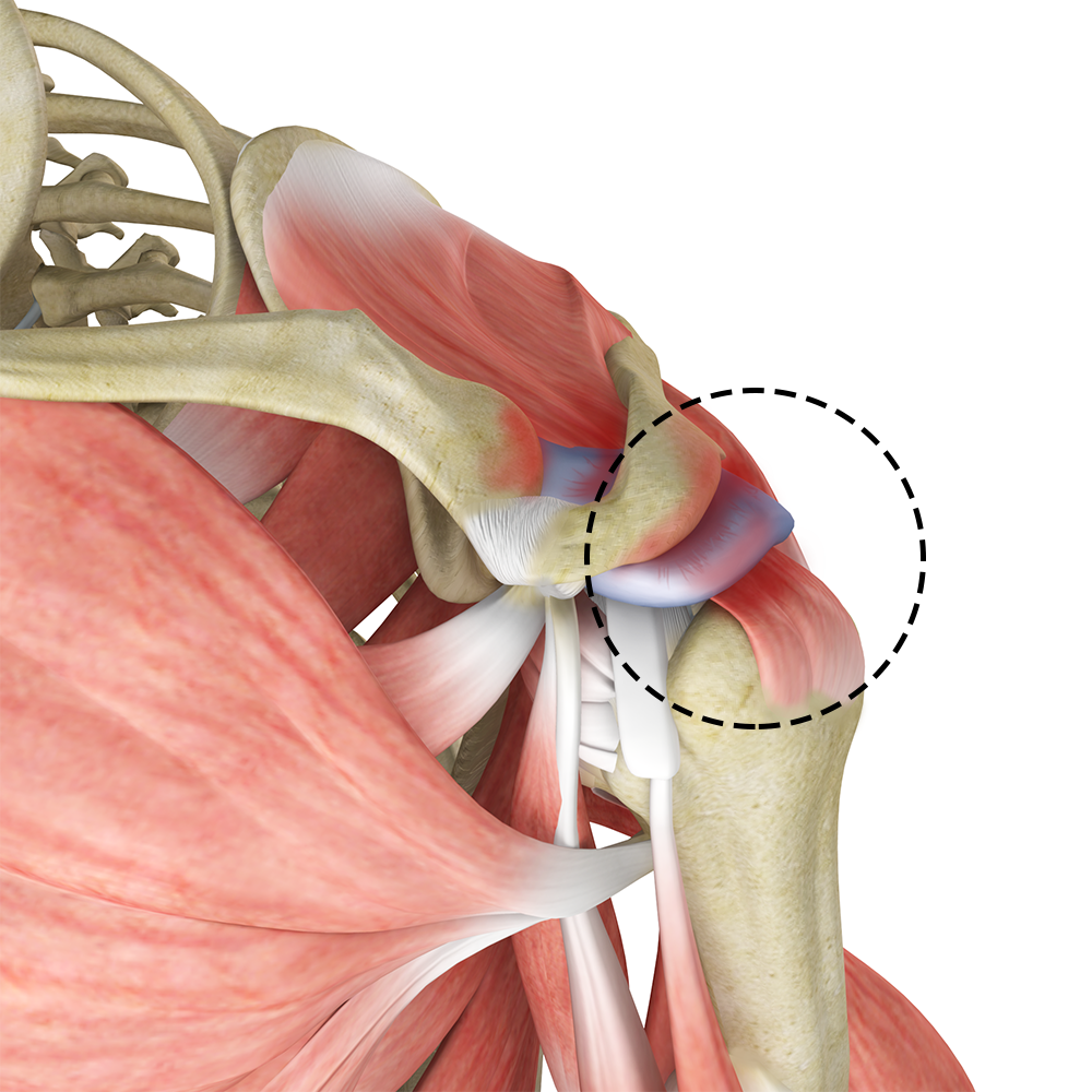 Rotator Cuff Pain Images