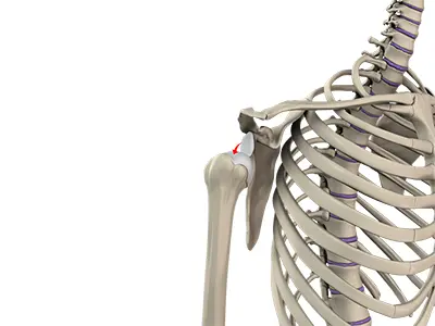 Shoulder Dislocation Images