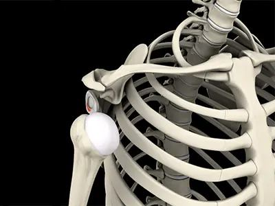 Shoulder Instability Images