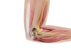 Ulnar Nerve Release Images