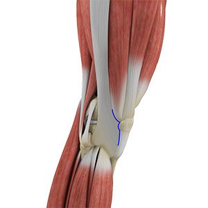 Subvastus and Midvastus Approach Total Knee Replacement pic
