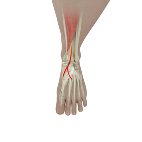 Anterior Tibialis Tendon Repair Educational Picture