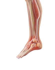 Foot Drop Educational Picture