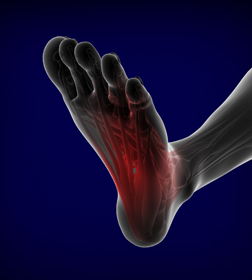 Foot Spasms Educational Picture