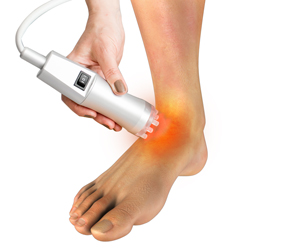 Laser therapy for Foot & Ankle Pain Educational Picture