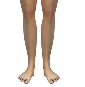 Out-Toeing Educational Picture