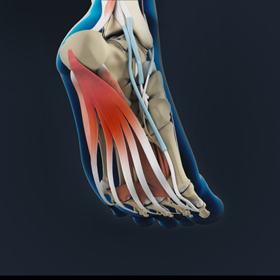 Plantar Fascia Release Educational Picture