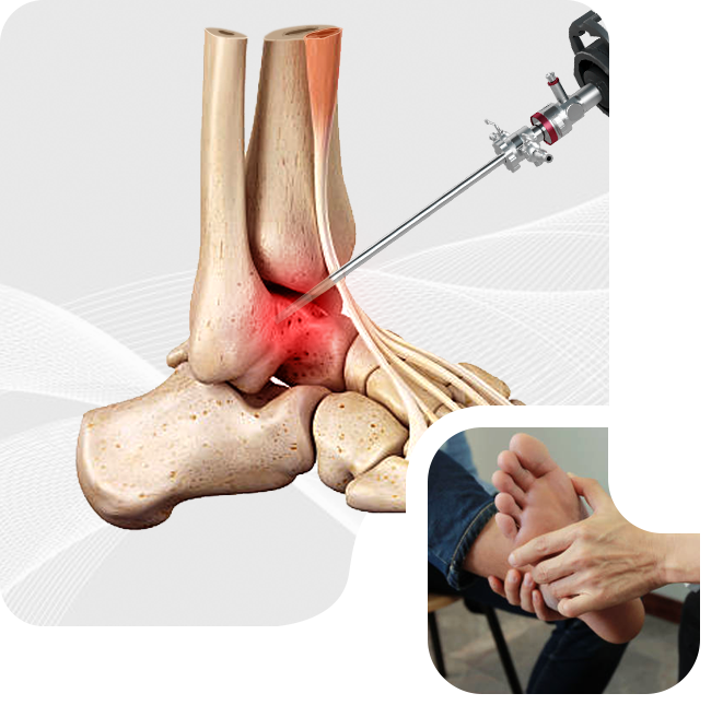 Minimally Invasive Surgery Treatment