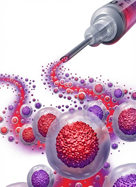 Non-surgical Treatments