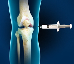 Nonsurgical Knee Treatments Images