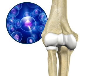 Orthobiologic Treatments for the Elbow Images