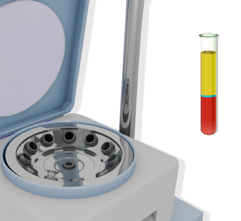 Platelet-Rich Plasma (PRP) Injection Images