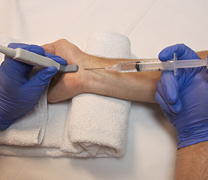 Small Joint Injections Images